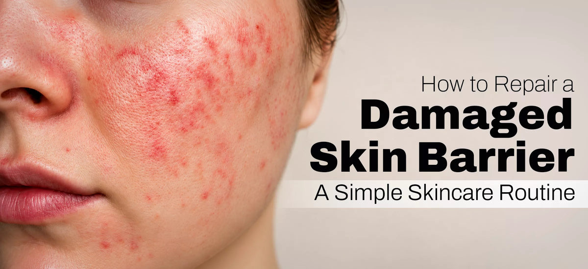 How to Repair a Damaged Skin Barrier: A Simple Skincare Routine